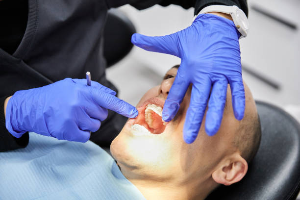 Best Emergency Tooth Extraction in Abilene, TX